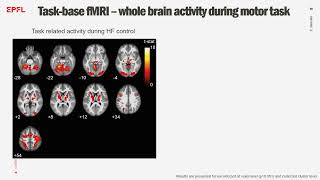 OHBM 2022  259  Symposium  Elena Beanato  Modulation of human striatal activity with temporal … [upl. by Nnyrb]