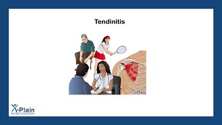 Tendinitis [upl. by Gene]