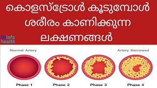 കോളസ്ട്രോൾ കൂടുമ്പോൾ ശരീരം കാണിക്കുന്ന ലക്ഷണങ്ങൾ Symptoms of high cholesterol in the bodymalayalam [upl. by Ikkin]