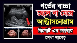 আল্ট্রাসনোগ্রাম রিপোর্ট এর ১ টি সংকেত দেখে জেনে নিন গর্ভের সন্তান ছেলে নাকি মেয়ে। ultrasound report [upl. by Llij]