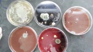 Fungal contaminated various culture plates [upl. by Vasilis744]