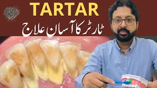 How to Remove TARTAR from Teeth at Home Naturally [upl. by Piks]