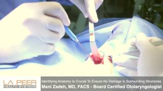 Watch Parathyroidectomy Surgery Performed by Dr Zadeh at La Peer Surgery Center [upl. by Yekcor]