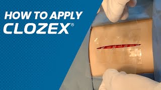 How To Apply ClozexⓇ [upl. by Abdulla]