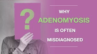 Adenomyosis Symptoms Why Adenomyosis Is Often Misdiagnosed And What to Do About It [upl. by Timofei784]