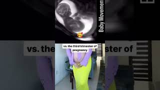 Ultrasound scan in second trimester pregnancy mother womb 🤱 baby kicking 🥰viralshort [upl. by Lucinda]