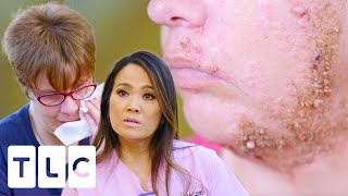 Patient Begs Dr Lee For Numbing Cream Before Her Treatment I Dr Pimple Popper [upl. by Madelin]