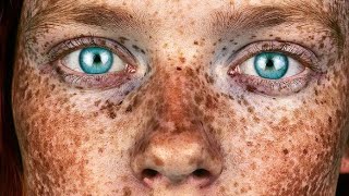 Freckles subliminal [upl. by Rozalie]