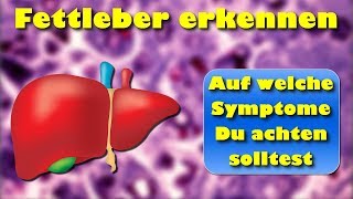 Fettleber erkennen – auf welche Symptome Du achten solltest [upl. by Domenic]