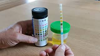 How to use urine test strips 10 parameters [upl. by Aicercul433]