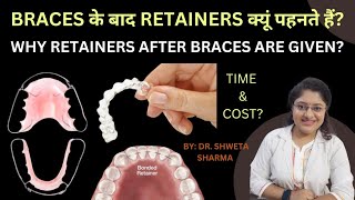 Retainers After Braces in Hindi Cost Time Why Retainers Are Important [upl. by Nett]