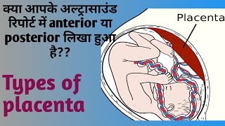 Types of placenta position।। What is anterior and posterior placentae [upl. by Neenej]