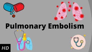 Pulmonary embolism Causes Signs and Symptoms Diagnosis and Treatment [upl. by Amalie]