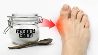 The 1 Remedy for Gout Attacks WORKS FAST  Dr Berg [upl. by Quent]