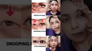 📛♨️reduce undereyebagsdroopingeyeseyes widening antiaging yoga 📛📛yoga [upl. by Mossberg245]