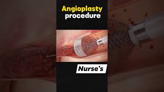 Angioplasty procedurehospital mbbs doctor shortvideo youtubeshorts trending shorts 🧐🥺😱👍🥹 [upl. by Hairas]