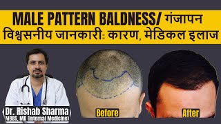 Causes Best Treatment Home Remedies In Hindi I Androgenic Alopecia I Male Pattern Baldness Cure [upl. by Repohtsirhc365]