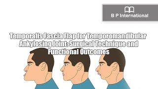 Temporalis Fascia Flap for Temporomandibular Ankylosing Joint Surgical Technique [upl. by Adnerad]