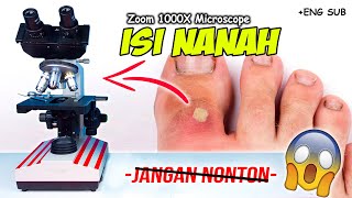 INILAH ISI NANAH DI MIKROSKOP  Pus Under Microscope Zoom 1000X [upl. by Eliak]