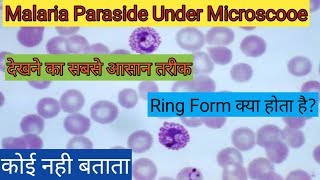 Malaria parasite under microscope  malaria test procedure [upl. by Sallie41]