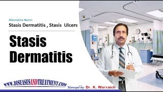 Stasis Dermatitis and Ulcers  Causes Diagnosis Symptoms Treatment Prognosis [upl. by Airamahs520]