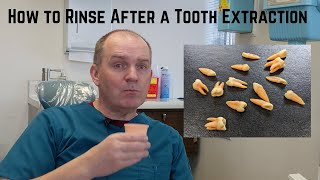 How to rinse gently after dental surgery [upl. by Rives]