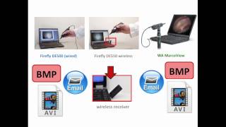 Video Otoscope Comparison [upl. by Macgregor]