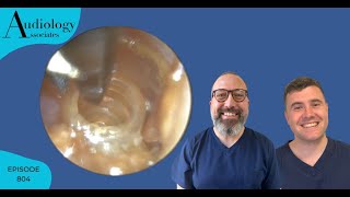 EAR WAX REMOVAL COMPILATION INC FOREIGN BODY REMOVAL EP804 [upl. by Anomor]