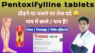 Trental 400 mg tablet  Trental 400 mg  Pentoxifylline tablets  Pentoxifylline uses [upl. by Pollard]