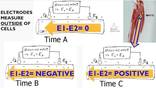 Electromyography EMG Biopac lecture [upl. by Brittni294]