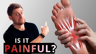 Plantar Fasciitis Heel Pain Treatment  What REALLY Works [upl. by Savage]