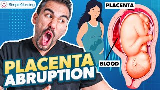 Placental Abruption Symptoms Causes Nursing Interventions  NCLEX Tips [upl. by Ecarret]