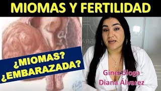 MIOMAS FERTILIDAD Y EMBARAZO POR GINECÓLOGA DIANA ALVAREZ [upl. by Adamek856]