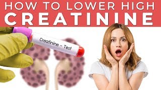 How to Lower HIGH CREATININE levels  KIDNEY HEALTH [upl. by Kirit]