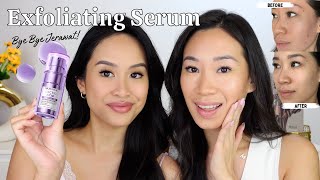 Skin Renewal Exfoliating Serum Bisa Sembuhin Jerawat PMS  Lactic Acid Serum [upl. by Lehcir]