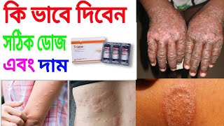 trialon ইনজেকশন এর কাজ কি full review Bangla [upl. by Leland664]