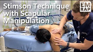 Stimson Technique with Scapular Manipulation [upl. by Melody926]