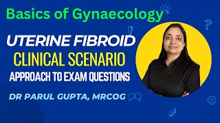 Fibroid Uterus  Clinical scenario questions  Clinical Examination points [upl. by Nilyahs685]