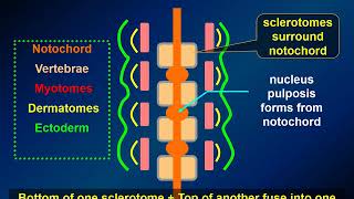 MedPix Video  Nonglial Tumors Chordoma Radiology [upl. by Yvette]