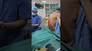 Spinal Anaesthesia for Low Cardiac Reserve patient low EFanesthesia spinal [upl. by Dumah]