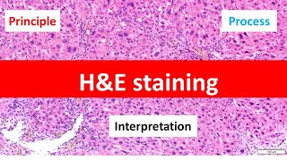 HE Staining Principle Procedure and Interpretation  Haematoxylin and Eosin Staining [upl. by Finbar]