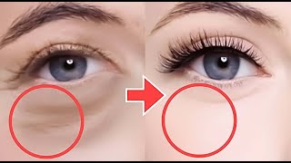 Eye Lifting Massage For Eye Bags Eye Wrinkles Dark Circles Under Eyes Droopy Eyelids Bigger Eye [upl. by Becker777]