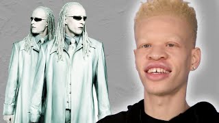 People With Albinism Review Albino Characters From Film [upl. by Annabal781]