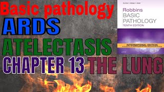 ARDS and atelectasiscollapse robbins basic pathologythe lung [upl. by Hteik]