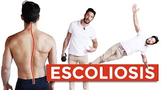 5 Ejercicios para la ESCOLIOSIS ¿Cuando Es Grave y Qué Hacer [upl. by Kalvn]