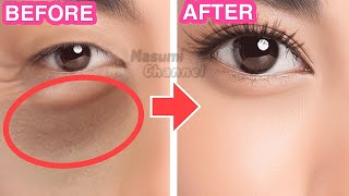 8mins AntiAging Eye Lifting Massage For Dark Circles Under Eye Sunken Eyes Eye Bags Bigger Eyes [upl. by Kennet]