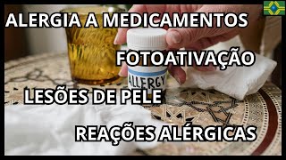 PRODUTOS QUÍMICOS  REAÇÕES ALÉRGICAS  ALERGIA A MEDICAMENTOS  LESÕES DE PELE  FOTOATIVAÇÃO [upl. by Kaile888]