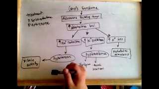 Conns syndrome hyperaldosteronism  cause and treatment [upl. by Liagibba]