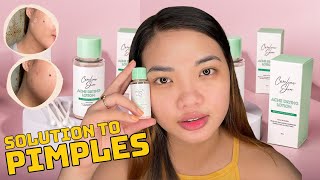 EFFECTIVE AT MABILIS NA PANTANGGAL PIMPLES  ACNE DRYING LOTION  CARELINE SKIN  SAGOT SA TAGYAWAT [upl. by Audrit]