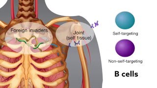 Chronic bacterial infection activates autoreactive B cells [upl. by Eggleston625]